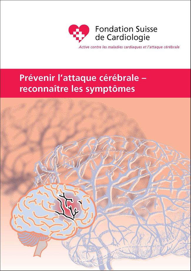 Prévenir l’attaque cérébrale – reconnaître les symptômes