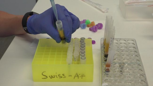 Swiss-AF-Burden Study Swiss-AF-Burden Study