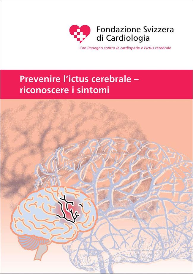 Prevenire l'ictus cerebrale - riconoscere i sintomi