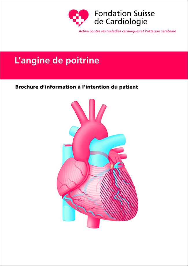 L'angine de poitrine