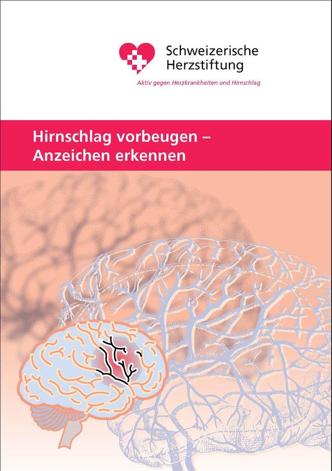 Hirnschlag vorbeugen - Anzeichen erkennen